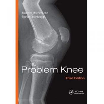 Knee Pain Relief Guide: Comprehensive Solutions for Joint Health