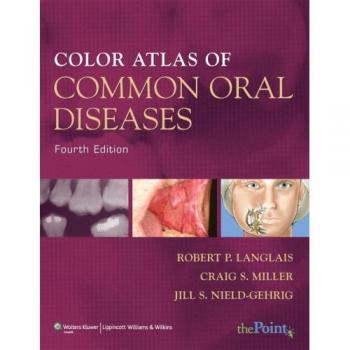 Color Atlas of Common Oral Diseases