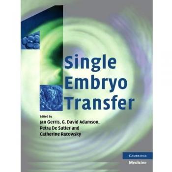 Transferencia de Embrión Único PB Cambridge