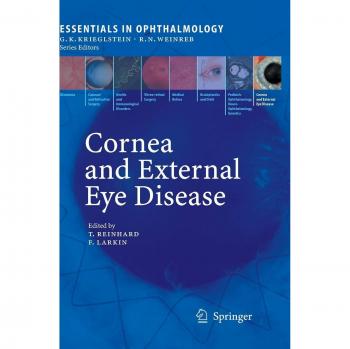 Ophthalmology Essentials: Cornea and External Eye Disease Guide