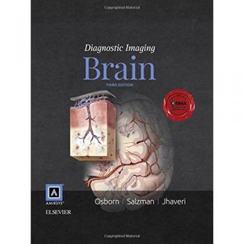 Diagnostic Imaging: Brain, 3e