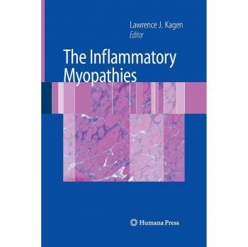 Comprehensive Guide to Inflammatory Myopathies: Springer Edition