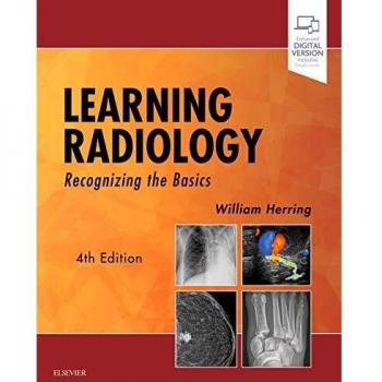 Learning Radiology: Recognizing the Basics
