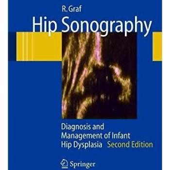 Hip Sonography: Diagnosis and Management of Infant Hip Dysplasia