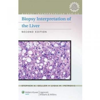 Biopsy Interpretation of the Liver