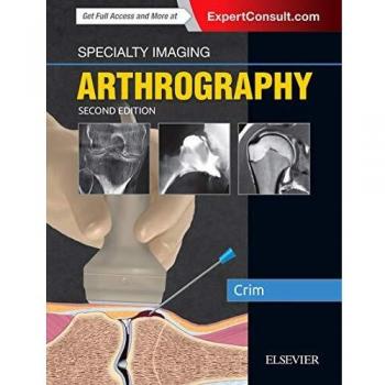 Specialty Imaging: Arthrography, 2e