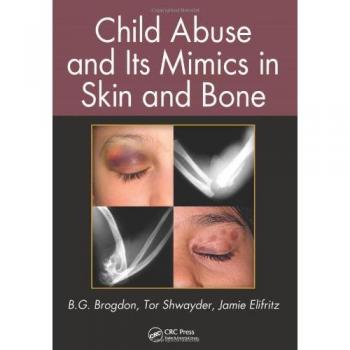Child Abuse and Its Mimics in Skin and Bone: Comprehensive Guide on Identification and Differentiation