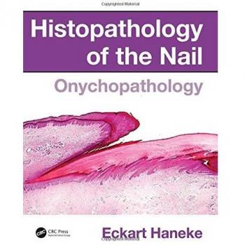 Histopathology of the Nail: Onychopathology