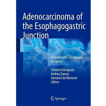 Adenocarcinoma of the Esophagogastric Junction: From Barrett's Esophagus to Cancer