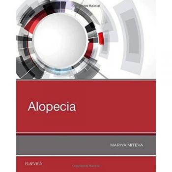 Alopecia, 1e