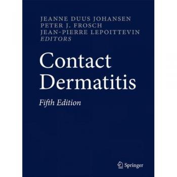 Contact Dermatitis