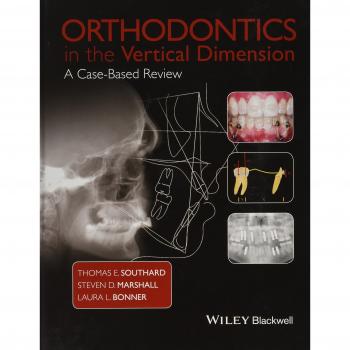 Orthodontics in the Vertical Dimension: A Case-Based Review