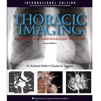 Thoracic Imaging: Pulmonary and Cardiovascular Radiology
