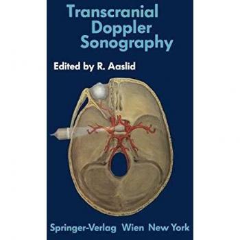 Transcranial Doppler Sonography