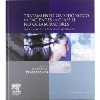Tratamiento ortodóncico en pacientes de clase II no colaboradores