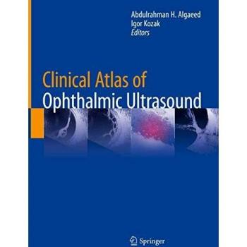 Clinical Atlas of Ophthalmic Ultrasound