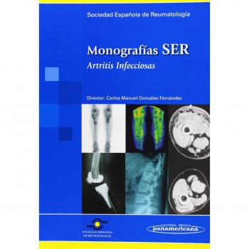 Monografias ser