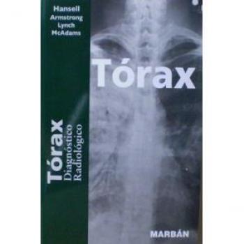 Tórax. Diagnostico radiológico