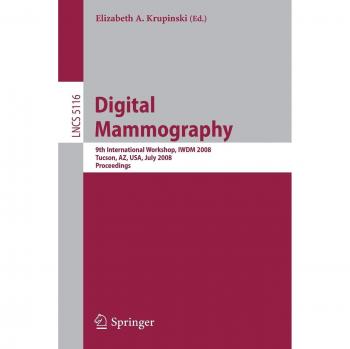 Digital Mammography