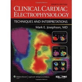 Clinical Cardiac Electrophysiology: Techniques and Interpretations