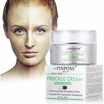 Anti Manchas Cara, Anti Manchas Piel, Crema blanqueadora, Anti Manchas regeneradora y aclarante, Crema Hidratante Aclarante y Anti Manchas, 30ml