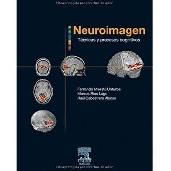 Neuroimagen. Técnicas y procesos cognitivos