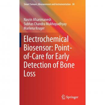 Electrochemical Biosensor: Point-of-Care for Early Detection of Bone Loss
