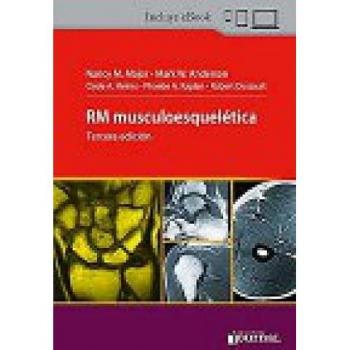 RM MUSCULOESQUELETICA