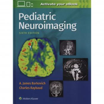 Pediatric Neuroimaging