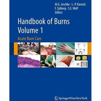 Handbook of Burns Volume 1: Acute Burn Care