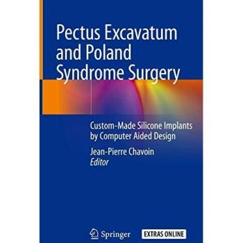 Pectus Excavatum and Poland Syndrome Surgery: Custom-Made Silicone Implants by Computer Aided Design