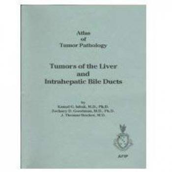 Tumors of the Liver and Intrahepatic Bile Ducts: 31