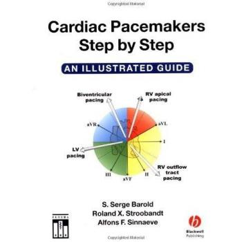Cardiac Pacemakers Step by Step: An Illustrated Guide
