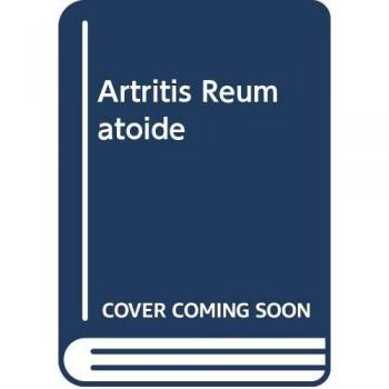 Artritis reumatoide: 2