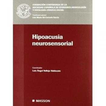 Hipoacusia neurosensorial