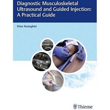 Diagnostic Musculoskeletal Ultrasound and Guided Injection: A Practical Guide