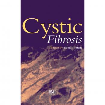 Fibrosis Quística: Guía Completa en Tapa Dura por Dennis J. Shale