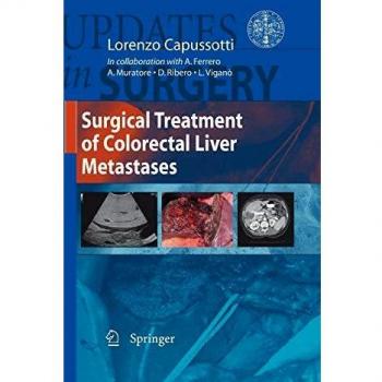 Surgical treatment of colorectal liver metastases