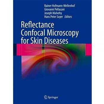 Reflectance Confocal Microscopy for Skin Diseases
