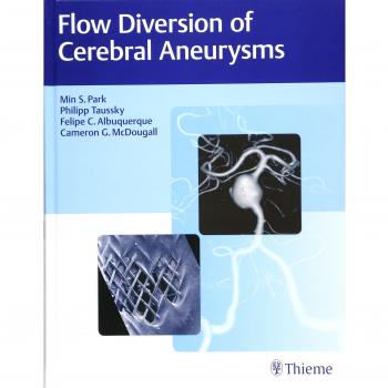 Flow Diversion of Cerebral Aneurysms