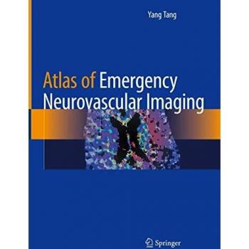 Atlas of Emergency Neurovascular Imaging