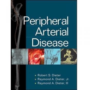 Peripheral Arterial Disease Management Guide - McGraw-Hill Edition