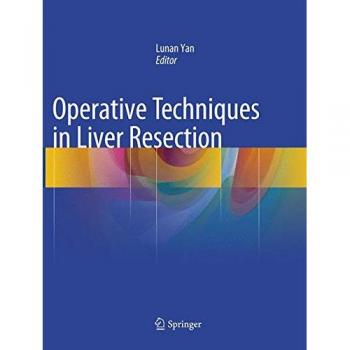 Operative Techniques in Liver Resection