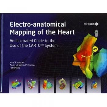 Electro-anatomical Mapping of the Heart