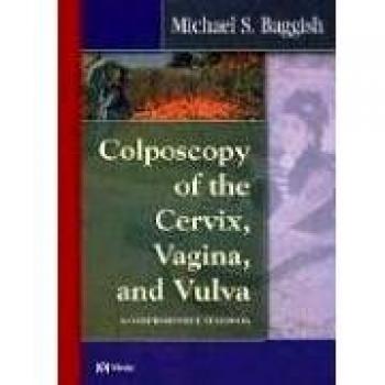 Colposcopy of the Cervix, Vagina, and Vulva: A Comprehensive Textbook, 1e