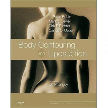 Body Contouring and Liposuction: Expert Consult - Online and Print, 1e