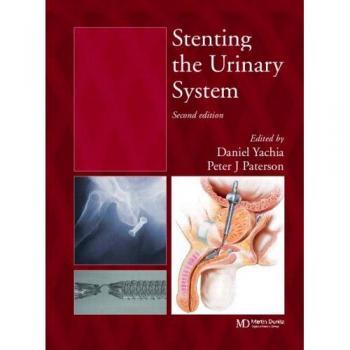 Stenting the Urinary System