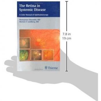 Retina in Systemic Disease: A Comprehensive Color Manual for Ophthalmoscopy