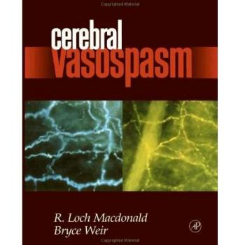 Cerebral Vasospasm