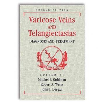 Varicose Veins and Telangiectasias: Diagnosis and Treatment, Second Edition